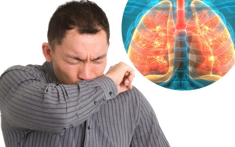Tuberculose: prevenção, diagnóstico e tratamento gratuito